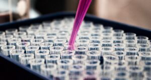 Tumori cerebrali, la svolta di ENEA: impulsi elettrici e anticorpi “coltivati” nelle piante per sconfiggere il glioblastoma